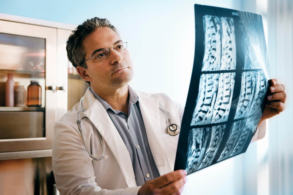 Male doctor looking at MRI scan of spinal cord injury